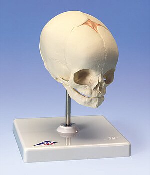 Cráneo de feto, sobre soporte  A26