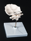 Atlas y axis con lamina horizontal del occipital Montado sobre soporte, desmontable.  A71/5