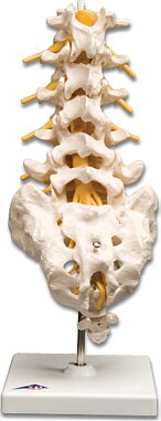 Columna vertebral lumbar  A74