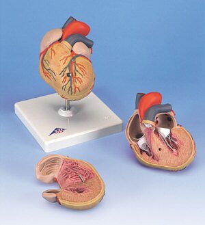 Corazón clásico con hipertrofia ventricular izquierda (HVI), de 2 piezas  G04