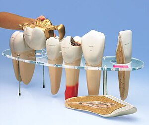 Modelo de prótesis dental, 7 piezas, 10 veces su tamaño natural -  Inglés  W42517