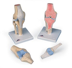 Modelo de la articulación de la rodilla, dividido en 3 partes  A89