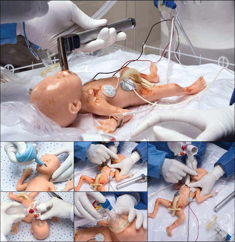 Simulador realista de bebé prematuro de 24 semanas p/prácticas de BVM, RCP e inyecciones S108.100