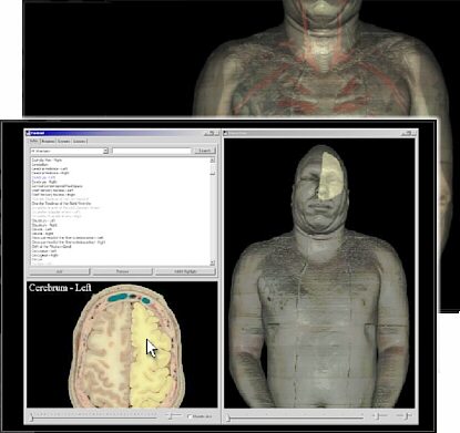 Software Virtual Human Dissector - Licencia p/1 puesto de Docente VHD-PROT